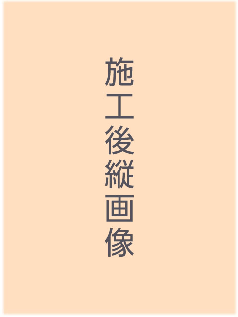 施工後縦画像